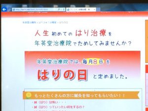 鍼の体験治療の日